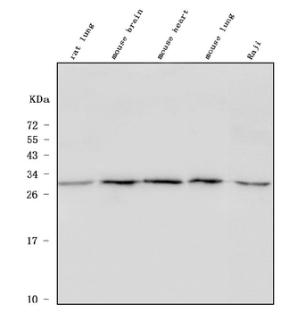 ULBP1 Antibody