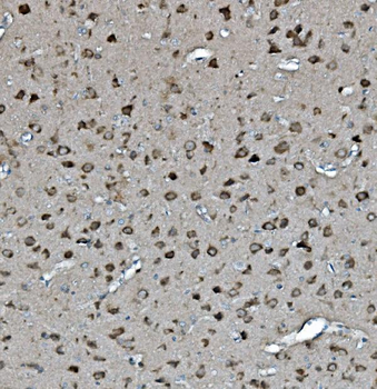 YWHAE Rabbit Polyclonal Antibody