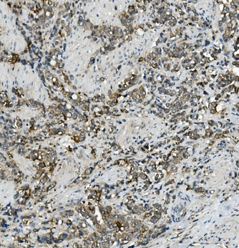 MRP5/ABCC5 Rabbit Polyclonal Antibody