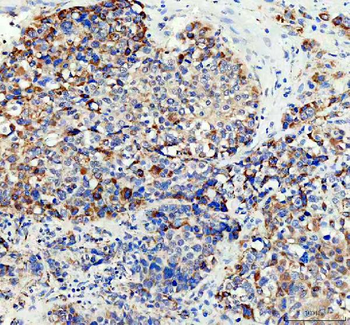 ACADS/SCAD Rabbit Polyclonal Antibody