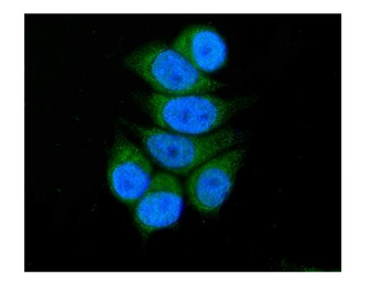 SBCAD/ACADSB Rabbit Polyclonal Antibody