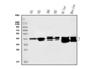 SBCAD/ACADSB Rabbit Polyclonal Antibody