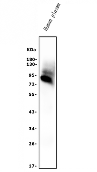 AFM Rabbit Polyclonal Antibody