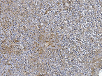 Afm Rabbit Polyclonal Antibody