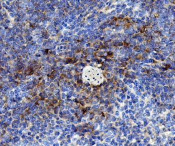 Cd59 Rabbit Polyclonal Antibody