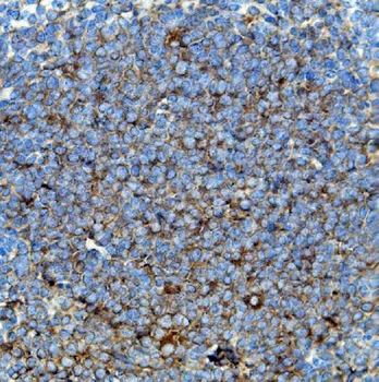 Cd63 Rabbit Polyclonal Antibody