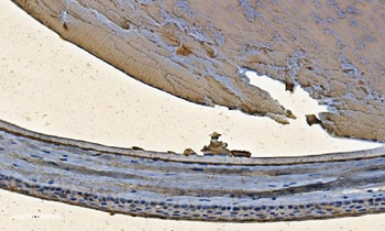 Alpha B Crystallin/CRYAB Antibody