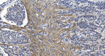 Alpha B Crystallin/CRYAB Antibody