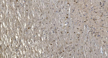 Alpha B Crystallin/CRYAB Antibody