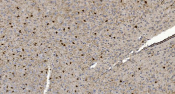 Alpha B Crystallin/CRYAB Antibody