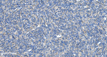 DRP1/DNM1L Antibody