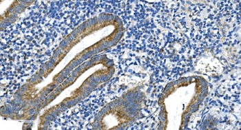 DRP1/DNM1L Antibody