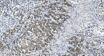 DRP1/DNM1L Antibody