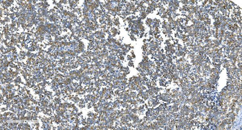 DRP1/DNM1L Antibody