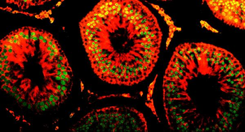 DR1 Rabbit Polyclonal Antibody