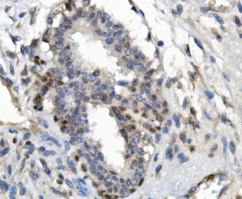 FOXP1 Rabbit Polyclonal Antibody