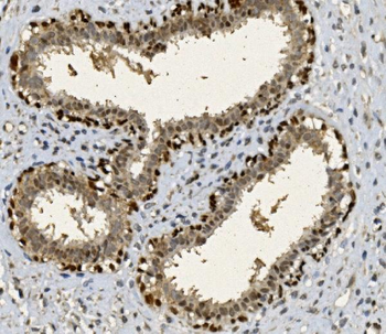 FOXP1 Rabbit Polyclonal Antibody