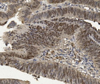 FOXP1 Rabbit Polyclonal Antibody