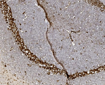 FOXP1 Rabbit Polyclonal Antibody