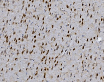 FOXP1 Rabbit Polyclonal Antibody