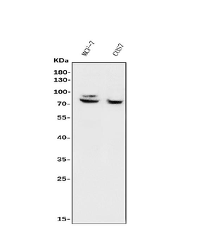 FOXP1 Rabbit Polyclonal Antibody