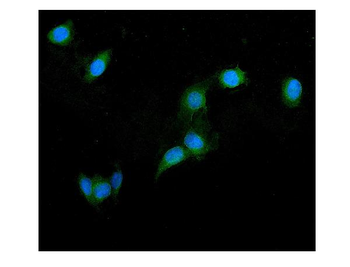 GRK2 Rabbit Polyclonal Antibody
