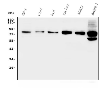 GRK2 Rabbit Polyclonal Antibody