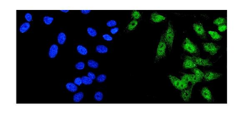 HDAC5 Rabbit Polyclonal Antibody