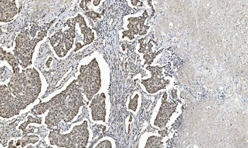 HDAC5 Rabbit Polyclonal Antibody