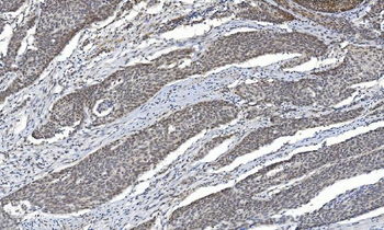 HDAC5 Rabbit Polyclonal Antibody