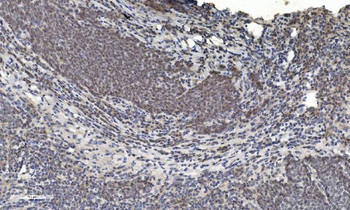 HDAC5 Rabbit Polyclonal Antibody