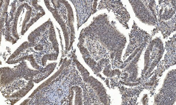 HDAC5 Rabbit Polyclonal Antibody