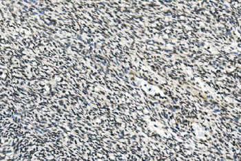 HOXD11 Rabbit Polyclonal Antibody