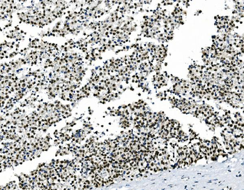 HOXD11 Rabbit Polyclonal Antibody