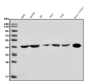 HOXD11 Rabbit Polyclonal Antibody