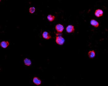 IL2 Receptor gamma/IL2RG Rabbit Polyclonal Antibody