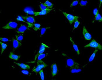 Inhibin alpha/INHA Rabbit Polyclonal Antibody