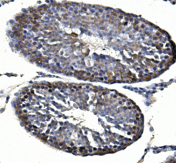 Inhibin alpha/INHA Rabbit Polyclonal Antibody