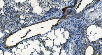 MCU Rabbit Polyclonal Antibody