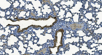 MCU Rabbit Polyclonal Antibody