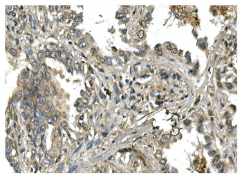 Mesp2 Rabbit Polyclonal Antibody