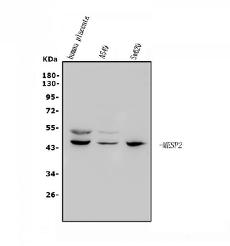 Mesp2 Rabbit Polyclonal Antibody