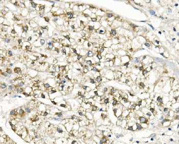 Slc25a1 Rabbit Polyclonal Antibody