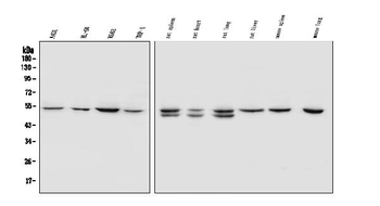 SOX11 Rabbit Polyclonal Antibody