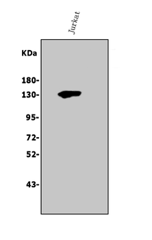 Thrombospondin/THBS1 Rabbit Polyclonal Antibody