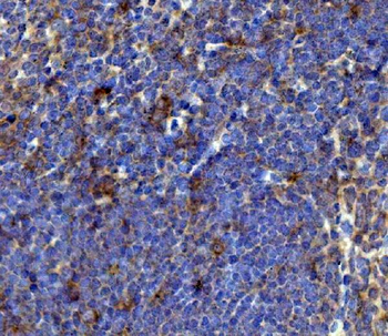BCMA/Tnfrsf17 Antibody
