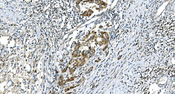 DR6/TNFRSF21 Rabbit Polyclonal Antibody