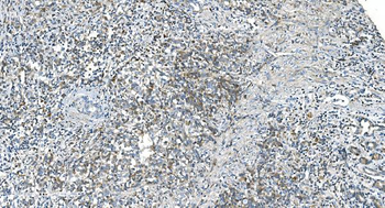 DR6/TNFRSF21 Rabbit Polyclonal Antibody