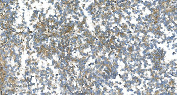 DR6/TNFRSF21 Rabbit Polyclonal Antibody