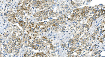 DR6/TNFRSF21 Rabbit Polyclonal Antibody